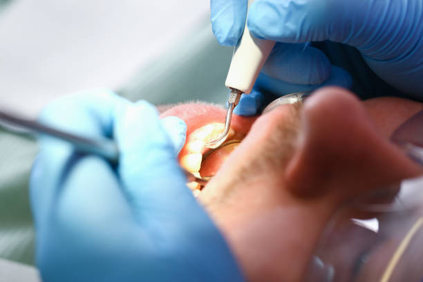 Best Emergency Gum Treatment in Colonial Heights, VA