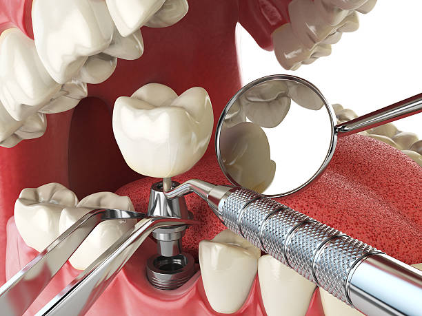Best Same-Day Emergency Dental Services in Colonial Heights, VA